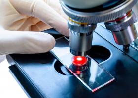 Il s’agit de mieux comprendre aussi les causes et les processus moléculaires sous-jacents de l'obésité Il s’agit de mieux comprendre aussi les causes et les processus moléculaires sous-jacents de l'obésité