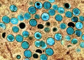 Une approche mondiale coordonnée est nécessaire pour prévenir de futures maladies zoonotiques (Visuel NIAID) Une approche mondiale coordonnée est nécessaire pour prévenir de futures maladies zoonotiques (Visuel NIAID)