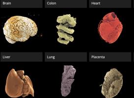 Ce nouveau portail 3D en libre accès permet aux utilisateurs d'explorer des organes humains intacts avec une précision sans précédent (Visuel GOOGLE EARTH screenshot of the Human Organ Atlas portal) Ce nouveau portail 3D en libre accès permet aux utilisateurs d'explorer des organes humains intacts avec une précision sans précédent (Visuel GOOGLE EARTH screenshot of the Human Organ Atlas portal)