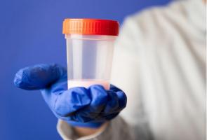 Collecte de sperme de patients Covid-19 (Visuel Eivind Senneset, Université de Bergen). Collecte de sperme de patients Covid-19 (Visuel Eivind Senneset, Université de Bergen).