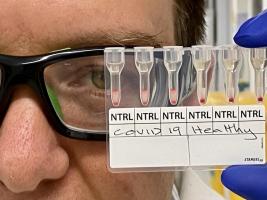 Il s’agit d’un test d'agglutination simple, praticable partout dans le monde, qui détecte en 20 mn l’infection COVID-19 (Visuel Monash University) Il s’agit d’un test d'agglutination simple, praticable partout dans le monde, qui détecte en 20 mn l’infection COVID-19 (Visuel Monash University)