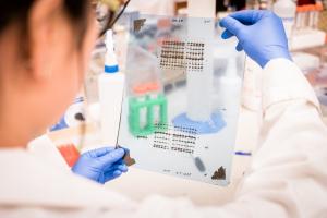 Uune partie des déficiences intellectuelles associées à la trisomie 21 peut être attribuée à une production de protéines altérée dans l'hippocampe Uune partie des déficiences intellectuelles associées à la trisomie 21 peut être attribuée à une production de protéines altérée dans l'hippocampe