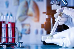 La patiente atteinte de leucémie et immunodéprimée, porteuse du coronavirus pendant au moins 105 jours et infectieuse pendant au moins 70 jours, est restée asymptomatique tout le temps (Visuel Adobe Stock 33294447). La patiente atteinte de leucémie et immunodéprimée, porteuse du coronavirus pendant au moins 105 jours et infectieuse pendant au moins 70 jours, est restée asymptomatique tout le temps (Visuel Adobe Stock 33294447).