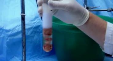 Parmi ces 13 nouveaux gènes de la maladie d'Alzheimer identifiés dans le cadre de cette étude génomique émergent de nouvelles cibles pour le développement de médicaments (Visuel Fotolia) Parmi ces 13 nouveaux gènes de la maladie d'Alzheimer identifiés dans le cadre de cette étude génomique émergent de nouvelles cibles pour le développement de médicaments (Visuel Fotolia)