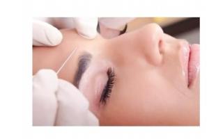 L'exercice facial accélère les effets anti-rides du Botox® L'exercice facial accélère les effets anti-rides du Botox®