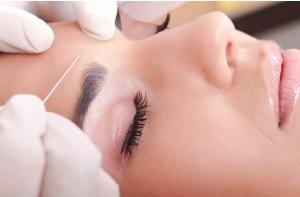 Une technique d'injection «microbotulinum» se fait innovante et moins invasive (Fotolia) Une technique d'injection «microbotulinum» se fait innovante et moins invasive (Fotolia)