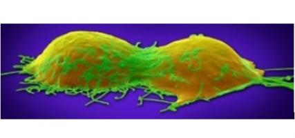 Les cancers ovariens et pancréatiques rares chez les jeunes femmes sont causés par des cellules qui se sont installées dans un organe autre que celui pour lequel elles avaient été conçues lors de l'embryogenèse Les cancers ovariens et pancréatiques rares chez les jeunes femmes sont causés par des cellules qui se sont installées dans un organe autre que celui pour lequel elles avaient été conçues lors de l'embryogenèse