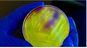 n plaidoyer de plus pour une thérapie encore mal acceptée par les patients mais qui progresse sur ce point avec de nouvelle formes d’administration comme la « poop pill ». n plaidoyer de plus pour une thérapie encore mal acceptée par les patients mais qui progresse sur ce point avec de nouvelle formes d’administration comme la « poop pill ».