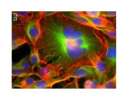 Telles des « tortues », ces cellules géantes polyploïdales se déplacent plus lentement que les autres cellules cancéreuses, mais vont plus loin, permettant ainsi à la tumeur de se propager ou de métastaser Telles des « tortues », ces cellules géantes polyploïdales se déplacent plus lentement que les autres cellules cancéreuses, mais vont plus loin, permettant ainsi à la tumeur de se propager ou de métastaser