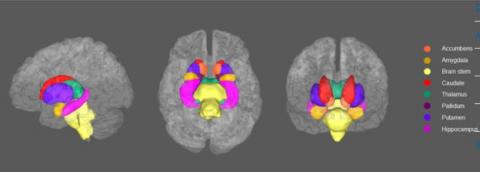 La dépression touche 1 personne sur 5 au cours de la vie La dépression touche 1 personne sur 5 au cours de la vie