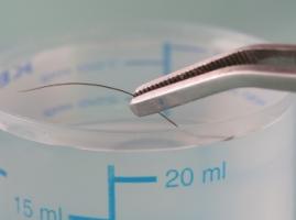 L'expression du gène MPST qui conduit à la surproduction d'hydrogène sulfuré est plus élevée dans le cerveau de patients atteints de certaines formes de schizophrénie. L'expression du gène MPST qui conduit à la surproduction d'hydrogène sulfuré est plus élevée dans le cerveau de patients atteints de certaines formes de schizophrénie.