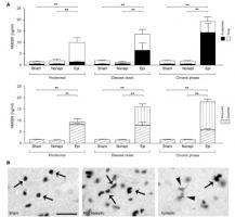 Environ 30% des patients atteints d'épilepsie connaissent toujours des crises et sont donc touchés d’« épilepsie réfractaire » Environ 30% des patients atteints d'épilepsie connaissent toujours des crises et sont donc touchés d’« épilepsie réfractaire »