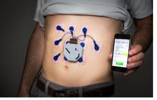 Ce mode de La surveillance de l'activité gastro-intestinale chez les patients en dehors du contexte clinique va permettre d’accroître la probabilité de capter les événements anormaux, tout en évitant certains examens invasifs, et de réduire les coûts. Ce mode de La surveillance de l'activité gastro-intestinale chez les patients en dehors du contexte clinique va permettre d’accroître la probabilité de capter les événements anormaux, tout en évitant certains examens invasifs, et de réduire les coûts.