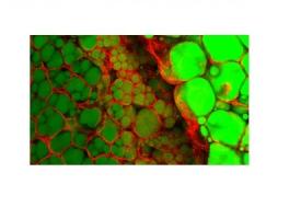 La phosphatidate phosphatase, une enzyme clé en relation avec l'obésité, la lipodystrophie, l'inflammation, le diabète La phosphatidate phosphatase, une enzyme clé en relation avec l'obésité, la lipodystrophie, l'inflammation, le diabète