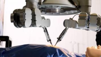 Le robot est utilisé ici pour suturer des vaisseaux de 0,3 à 0,8 millimètre dans le bras du patient Le robot est utilisé ici pour suturer des vaisseaux de 0,3 à 0,8 millimètre dans le bras du patient.