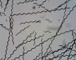 Ces nanorobots ont été développés en recouvrant des algues minuscules de particules magnétiques biocompatibles. Ces nanorobots ont été développés en recouvrant des algues minuscules de particules magnétiques biocompatibles.