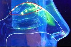 L'infection par le SRAS-CoV-2 touche des cellules non neuronales, pas les neurones récepteurs olfactifs (Visuel Fotolia) L'infection par le SRAS-CoV-2 touche des cellules non neuronales, pas les neurones récepteurs olfactifs (Visuel Fotolia)