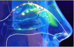 9 patients parkinsoniens sur 10 souffrent de déficiences de l’odorat 9 patients parkinsoniens sur 10 souffrent de déficiences de l’odorat