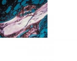 La technique permet de développer des échantillons d'os minéralisés tridimensionnels adaptés aux besoins des chirurgies reconstructives, maxillo-faciales et orthopédiques La technique permet de développer des échantillons d'os minéralisés tridimensionnels adaptés aux besoins des chirurgies reconstructives, maxillo-faciales et orthopédiques