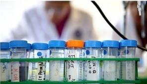 Ce nouveau test sanguin mis au point par des chercheurs de l'Université d'Uppsala et de l'Université de Göteborg promet la possibilité d’un diagnostic plus précis sans recourir à une intervention chirurgicale. Ce nouveau test sanguin mis au point par des chercheurs de l'Université d'Uppsala et de l'Université de Göteborg promet la possibilité d’un diagnostic plus précis sans recourir à une intervention chirurgicale.