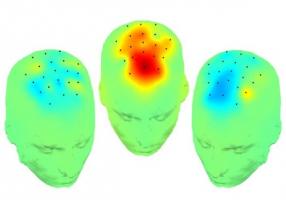 Ces enregistrements cérébraux peropératoires qui identifient une nouvelle connexion cérébrale révèlent aussi une cible prometteuse pour l'amélioration des symptômes cognitifs