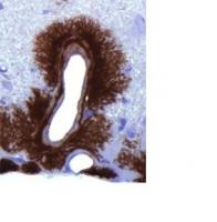 La protéine prion PrPC est la molécule responsable, dans sa version modifiée, de syndromes à prions tels que la maladie de Creuzfeldt Jacob