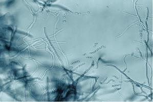 Cette bactérie qui vit dans « la poussière » démontre une activité anticancéreuse puissante, sélective contre les cellules de mélanome. Cette bactérie qui vit dans « la poussière » démontre une activité anticancéreuse puissante, sélective contre les cellules de mélanome.