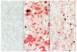 En substance, ce sucre naturel appelé tréhalose contribue à réduire le risque de diabète. En substance, ce sucre naturel appelé tréhalose contribue à réduire le risque de diabète.