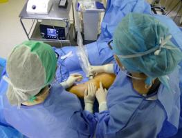 L’ablation thermique est aujourd’hui la technique de référence pour le traitement des varices.