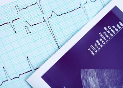 Suivre le régime DASH (Dietary Approaches to Stop Hypertension) connu pour ses bénéfices contre l’hypertension, peut également et considérablement réduire et prévenir le risque d'insuffisance cardiaque, chez les moins de 75 ans