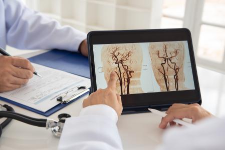 L'étude compare l’efficacité des médicaments thrombolytiques et de la récupération mécanique dans la prise en charge de certains accidents vasculaires cérébraux ischémiques (Visuel Adobe Stock 11006737954)