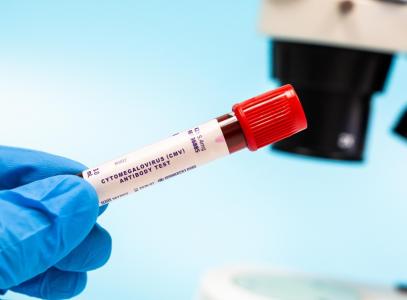 La recherche décrypte un mécanisme jusqu'alors méconnu par lequel le CMV qui infecte la majorité de la population adulte mondiale, pénètre dans les cellules qui tapissent les vaisseaux sanguins et contribue aux maladies vasculaires (Visuel Adobe Stock 1224533109)