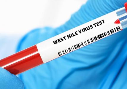 Cette équipe sensibilise et apporte de premières recommandations, dans l'objectif de pouvoir mieux détecter, prévenir, et prendre en charge la maladie (Visuel Adobe Stock 1599953667)