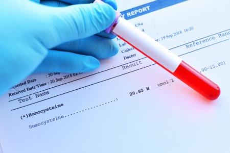 La réduction de la cystéine, un acide aminé, favorise la perte de poids (Visuel Adobe Stock 243324612)