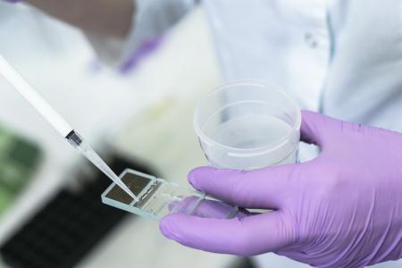 Cette large analyse alerte sur l’association entre l’exposition aux insecticides et une concentration plus faible des spermatozoïdes chez les hommes adultes (Visuel Adobe Stock 251608643)