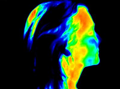 C’est une nouvelle application de l’intelligence artificielle dans le diagnostic, ici combinée à l'imagerie thermique faciale (Visuel Adobe Stock 252475008)