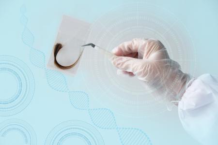 Une seule mèche de cheveux pourrait servir de biomarqueur de la sclérose latérale amyotrophique (SLA) (Visuel Adobe Stock 308320333)