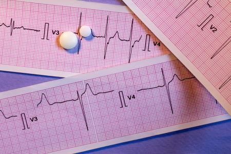 Ces comprimés combinés peuvent aider les patients souffrant d'hypertension à atteindre plus rapidement leurs objectifs tensionnels (Visuel Adobe Stock 327430681)