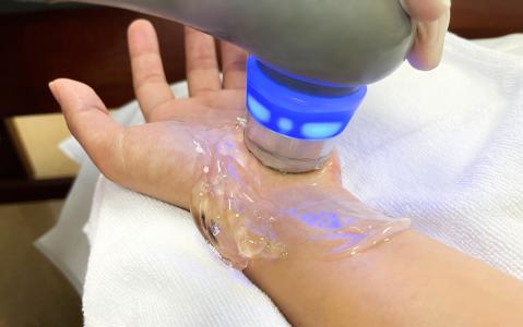 Cette approche innovante pourrait optimiser la chirurgie liée au syndrome du canal carpien : elle utilise l’angiographie à la fluorescéine qui permet d'évaluer le flux sanguin neural (Visuel Adobe Stock 477402413)