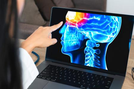 Des injections préalables de Botox permettent d’identifier les patients plus éligibles à la décompression nerveuse, une nouvelle approche chirurgicale qui « libère les nerfs » comprimés (Visuel Adobe Stock 521036904) 