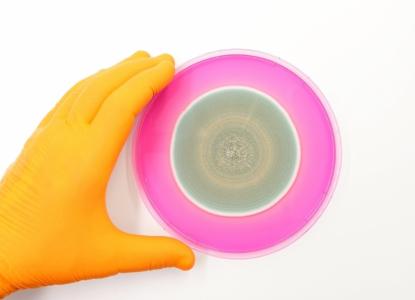 De nouvelles lignes directrices pour mieux gérer les infections fongiques causées par Candida (Visuel Adobe Stock 612964810)