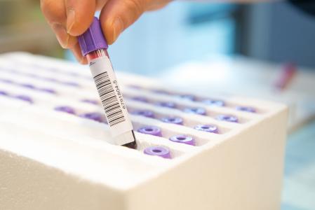 Ce test pourrait même révolutionner la façon dont les médecins préviennent les crises cardiaques et les accidents vasculaires cérébraux (AVC) en identifiant les patients les plus susceptibles de bénéficier de médicaments de prévention.(Visuel Adobe Stock 61724653)