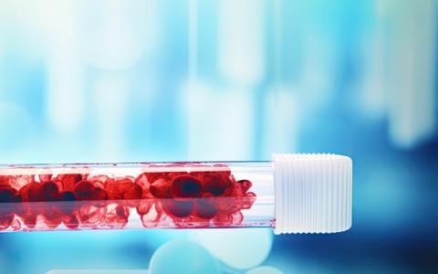 Ces plaquettes sanguines synthétiques aussi efficaces que les vraies pour arrêter les saignements  (Visuel Adobe Stock 692292375)