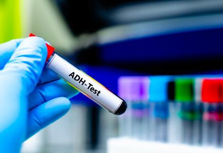 Repenser la psychiatrie grâce aux tests biologiques (Visuel Adobe Stock 962977838)