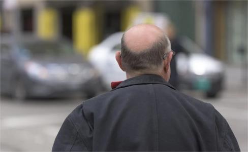 La perte de cheveux est souvent difficile à vivre (Visuel Pixabay)