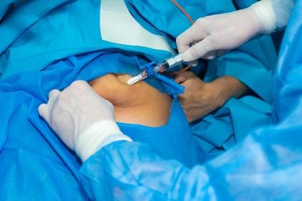 La perte de poids induite par la chirurgie bariatrique est-elle aussi associée à des changements dans la structure cérébrale et la cognition ? (Visuel Fotolia 178236449)