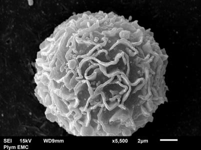 Ces travaux ouvrent la possibilité de cibler et de supprimer sélectivement les cellules pro-inflammatoires responsables de la maladie. 