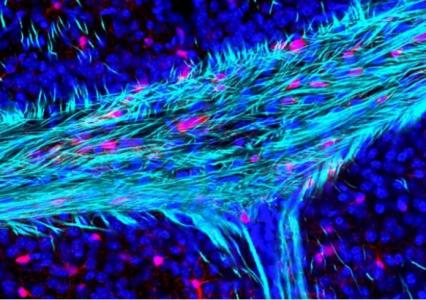 Ces travaux, publiés dans le Journal of Cell Biology confirment un lien entre la protéine TDP-43, la maladie neurodégénérative et un métabolisme défectueux du cholestérol (Visuel Fotolia).