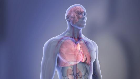 Plus de 40% des adultes sans maladie cardiaque connue présentent des dépôts graisseux dans les artères, ce qui suggère un certain degré d'athérosclérose et un risque accru de maladie et d’événement cardiovasculaire (Visuel AHA)