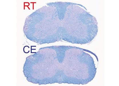 Les lésions démyélinisées apparaissent réduites en cas d’exposition au froid (EC sur visuel : exposed to cold) vs à température ambiante (RT : room temperature) (Visuel UNIGE - Laboratoires Trajkovski & Merkler /Métabolisme Cellulaire). 